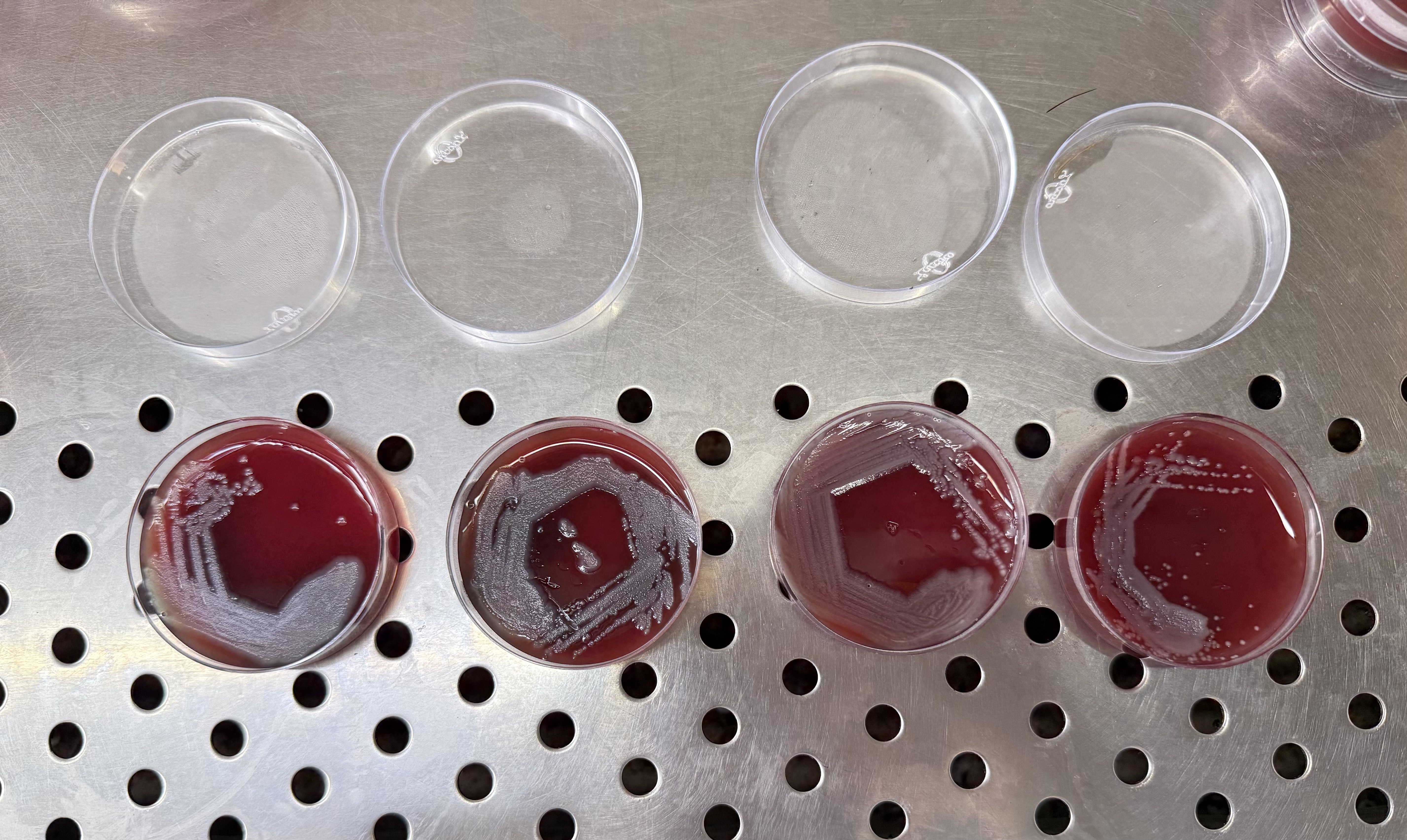 Petri dishes prepared during LVPEI microbiology research