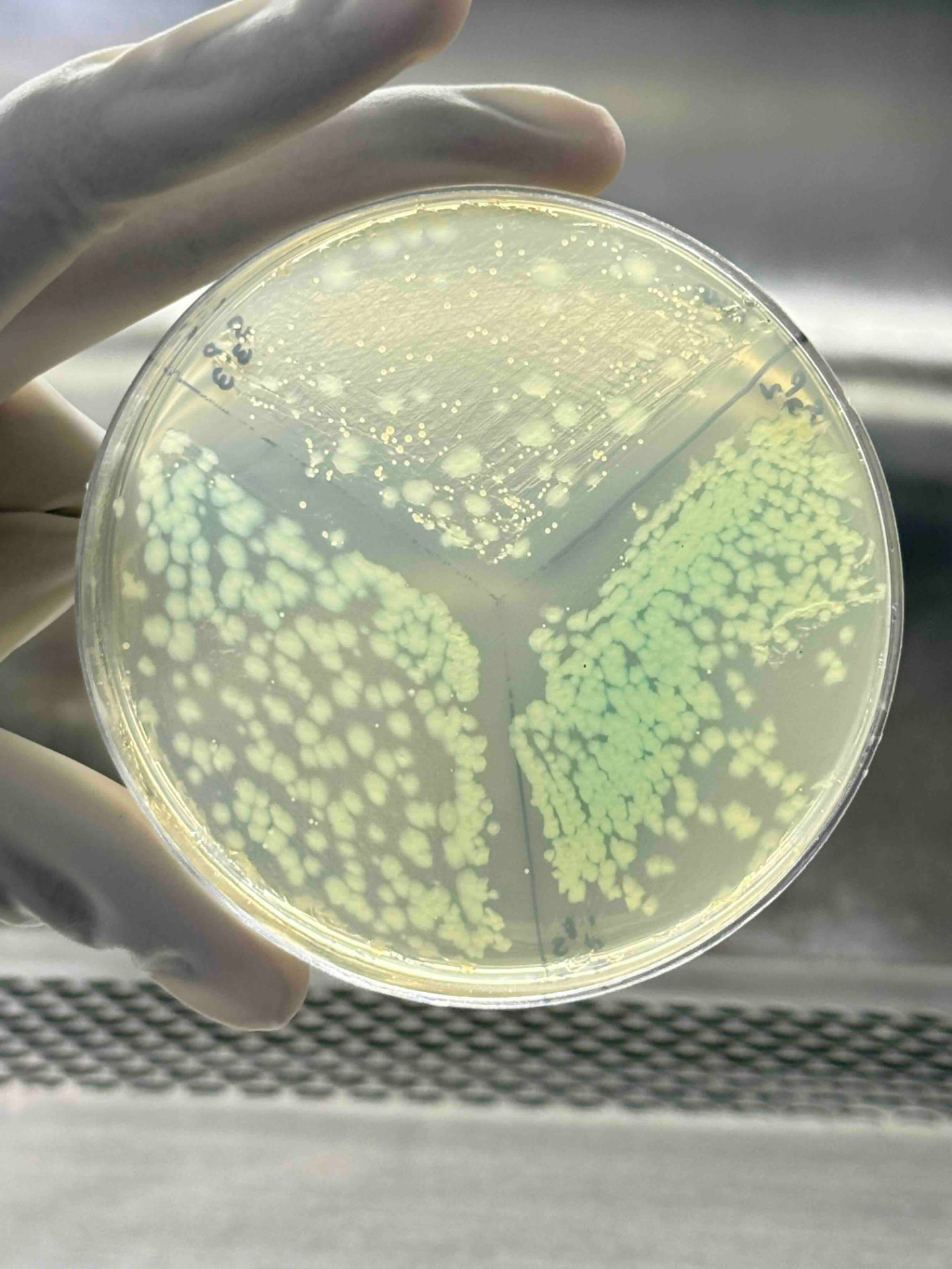 Bacterial culture plate showing colony growth during LVPEI microbiology research