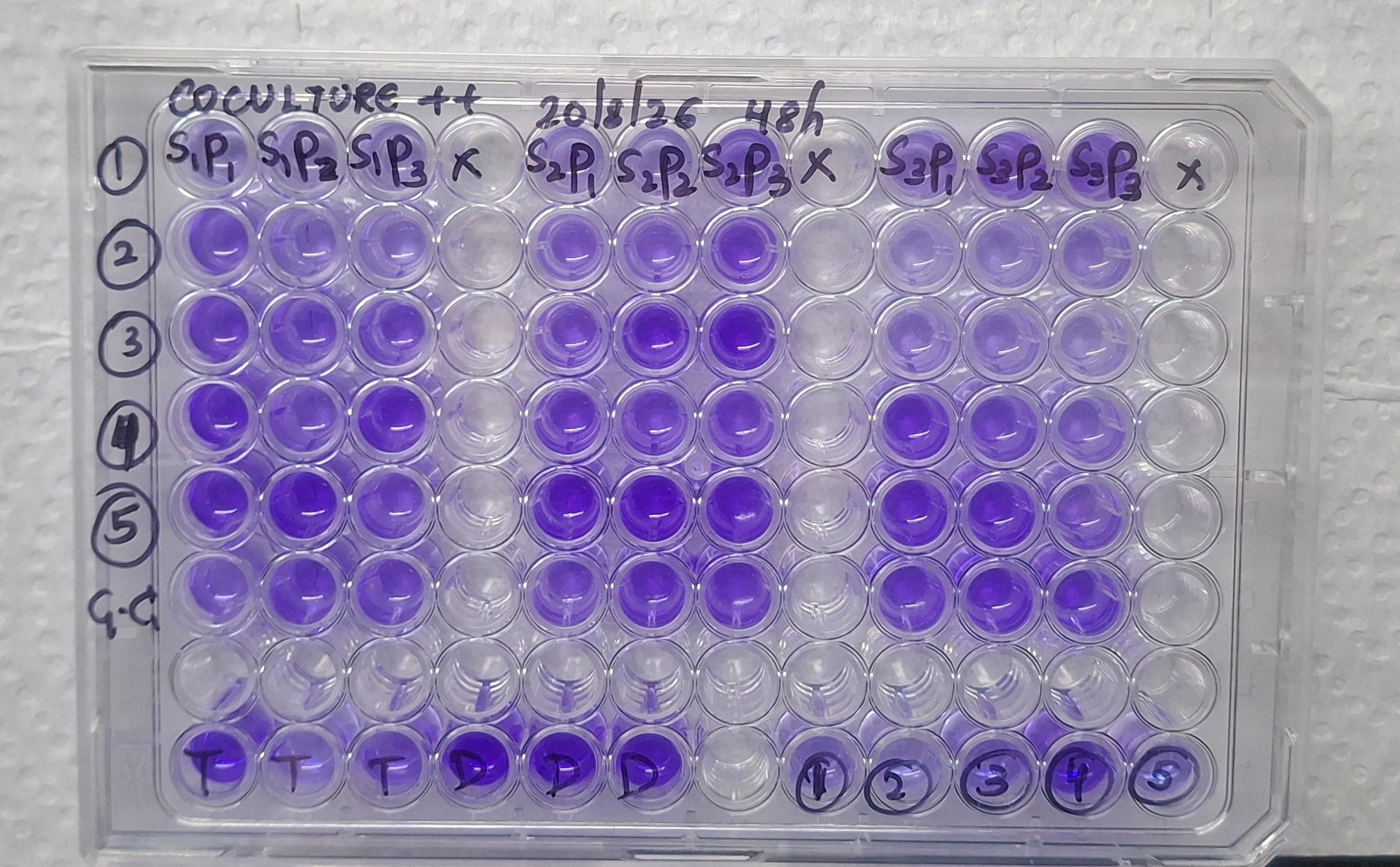 96-well plate assay for biofilm and antibiotic-tolerance experiments at LVPEI