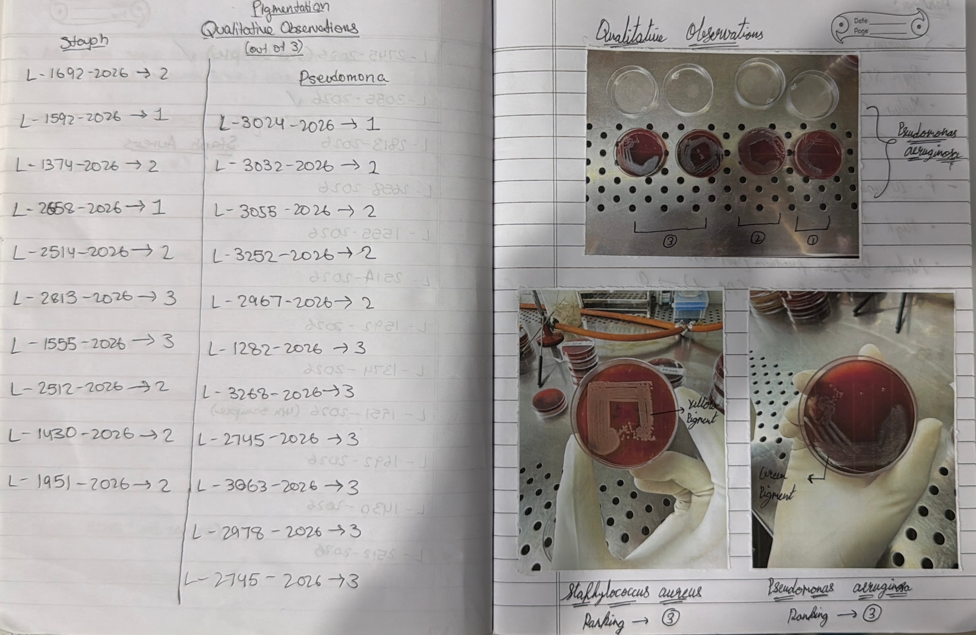 Handwritten microbiology observations and petri dish photographs from LVPEI research